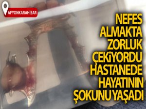 Nefes almakta zorluk çekiyordu hastanede hayatının şokunu yaşadı
