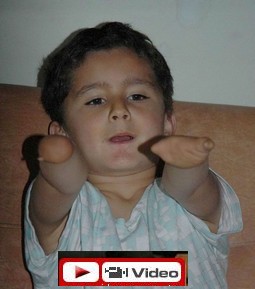 TEDAVİ OLUP OKULA GİTMEK İSTİYOR