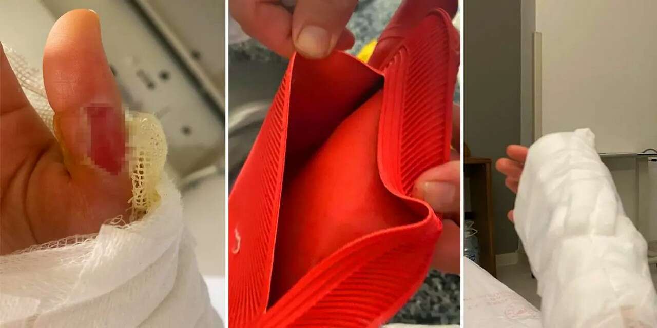 Sıcak Su Torbası Kâbusu: 3 Dakikada Patladı