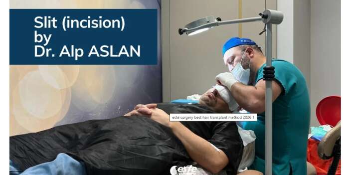 En İyi Saç Ekim Tekniği 2026