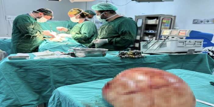 Van’da dev kistik kitle operasyonla temizlendi