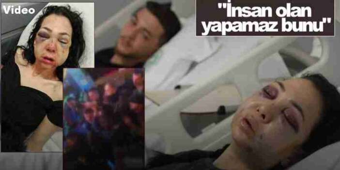 Bayram Günü Kabusa Döndü: Anneye Acımasız Saldırı