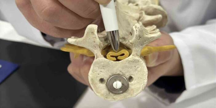 Bel ağrısı sandığınız şey tehlikeli olabilir!