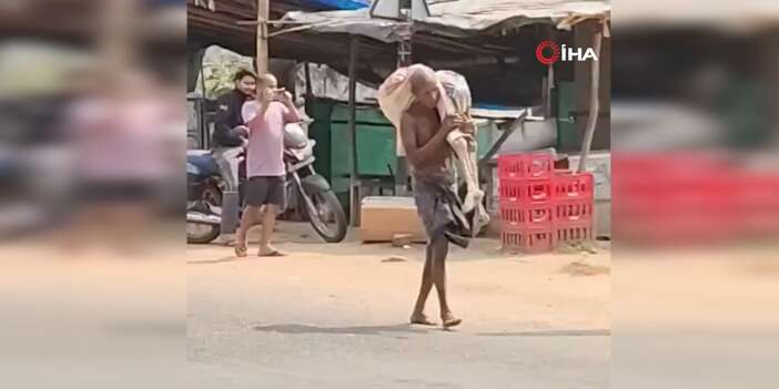 Kardeşinin iskeletiyle para çekmeye gitti