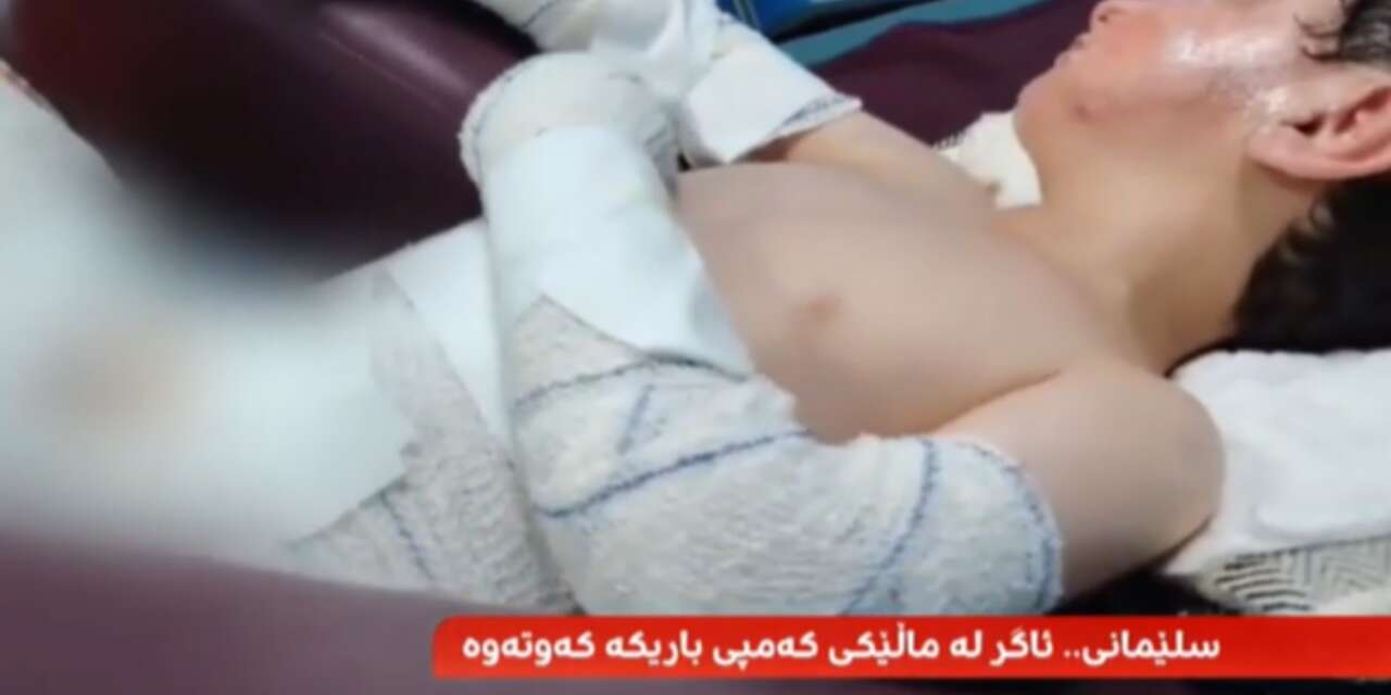 Şarjdaki telefon patladı: Anne ve çocuklar ağır yaralandı