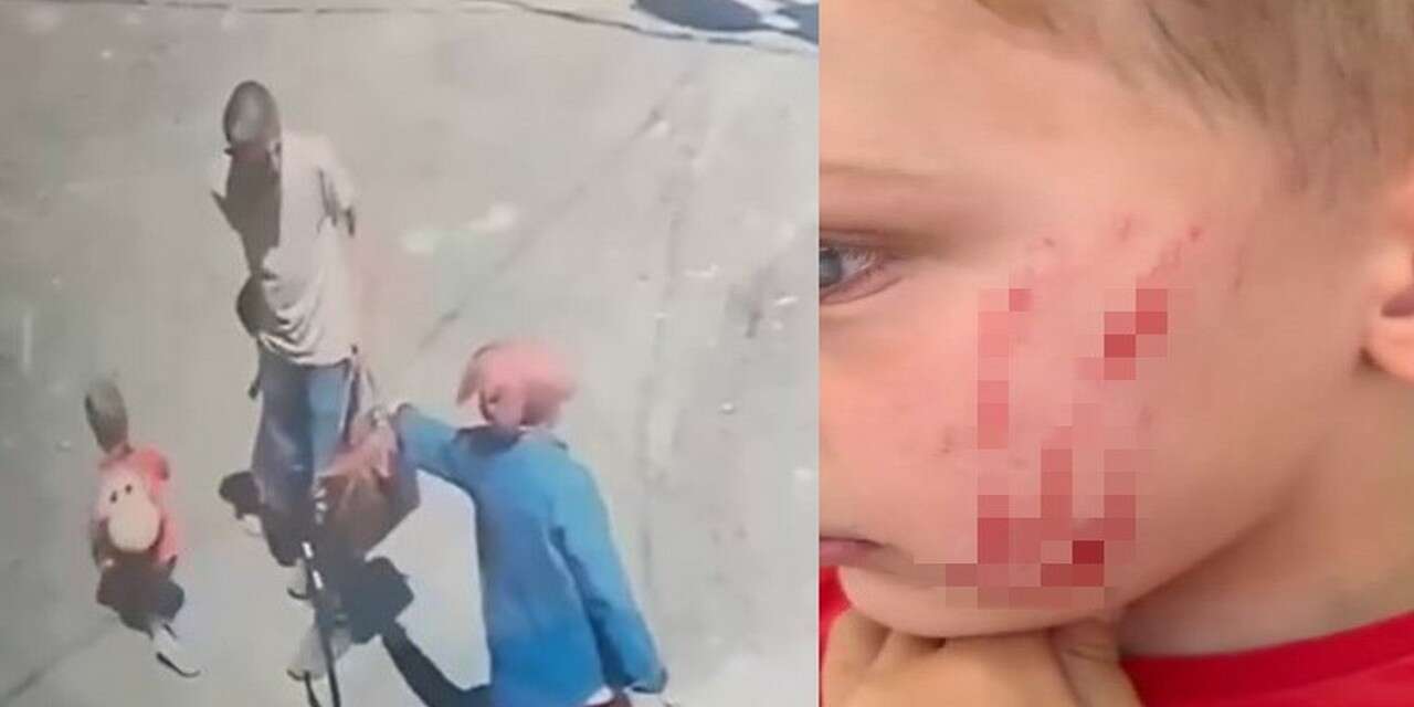 Sokakta oynayan çocuğa saldırı