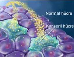 İŞTE KANSERİN 7 ÖNEMLİ BELİRTİSİ