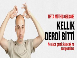 Kellik tarih oluyor! Müthiş gelişme
