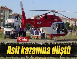 Asit kazanına düştü