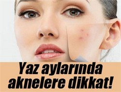 Aknelere dikkat