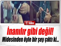 Midesinden öyle bir şey çıktı ki...