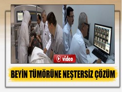 Beyin tümörüne neştersiz çözüm