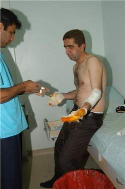 TÜP PATLADI 1 YARALI