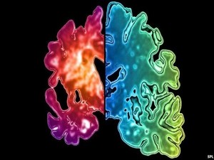 'Ameliyat, kan nakli ve diş tedavisinde Alzheimer bulaşabilir'