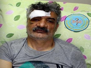 HDP'liler değil, kardeşlerim dövdü