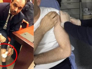 TBMM'deki kavgada kim kimi ısırdı!