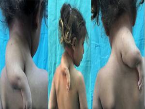 3. kolu boynunda dünyaya geldi