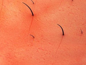 Kıl dönmesi hakkında yanlış bilinenler!