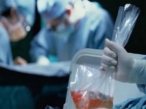 Her yıl 100 bin kişi organ bulunamadığı için ölüyor
