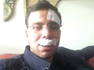 Ak Partili başkan kaza geçirdi!