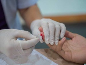 HIV belirtileri nelerdir?