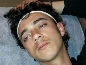 Afrin'de 23 ÖSO askeri zehirlendi