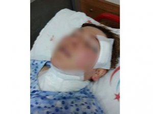 Şiddet gören kadın ölümden döndü
