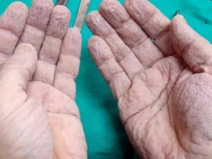 Cerrahın elleri sosyal medyayı salladı