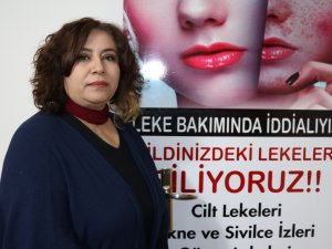 Güzellik uzmanlarından kışın cilt bakımı uyarısı