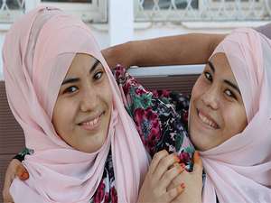 Siyam ikizleri tercih yapamadı