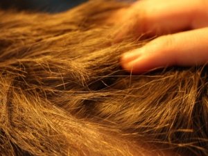 Soğuk kış aylarında saç dökülmelerine dikkat