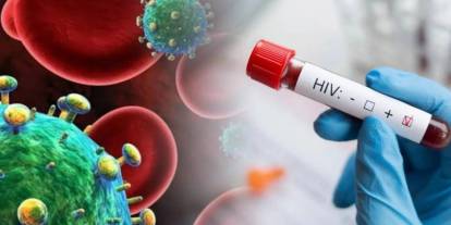 226 kişi AIDS hastalığına yakalandı